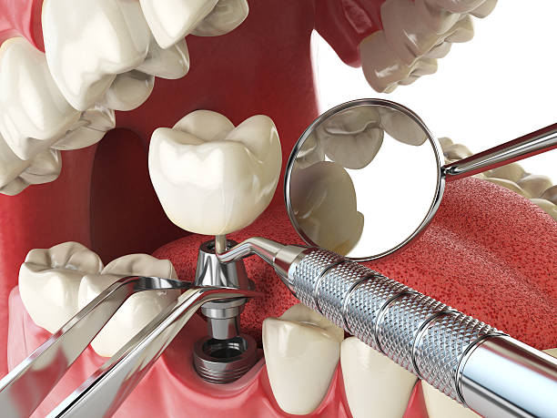 Best Emergency Broken Tooth Repair in Cherryville, PA